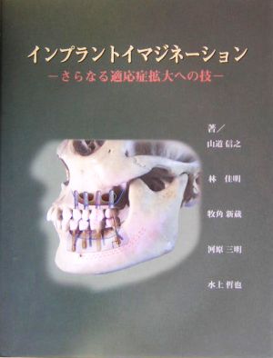 インプラントイマジネーション さらなる適応症拡大への技