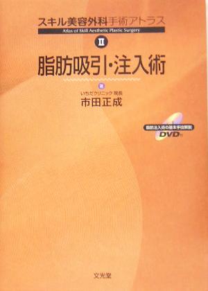 スキル美容外科手術アトラス(2) 脂肪吸引・注入術