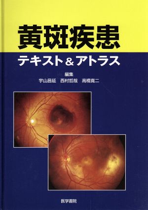 黄斑疾患テキスト&アトラス
