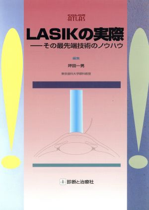 LASIKの実際 その最先端技術のノウハウ カラーアトラス