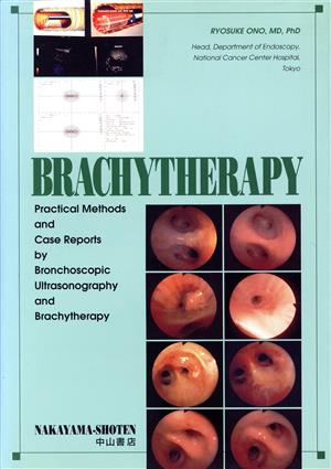 BRACHYTHERAPY