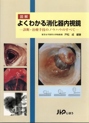 図解 よくわかる消化器内視鏡 診断・治療手技のノウハウのすべて