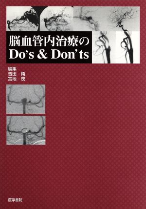 脳血管内治療のDo's & Don'ts