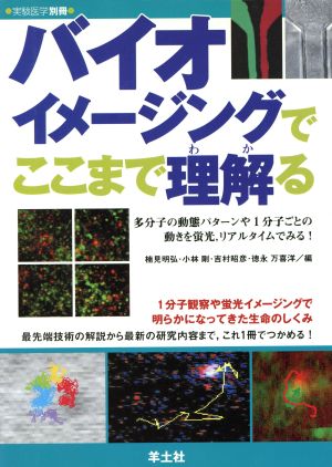 バイオイメージングでここまで理解る 多分子の動態パターンや1分子ごとの動きを蛍光、リアルタイムでみる！ 実験医学別冊