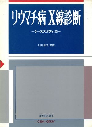 リウマチ病X線診断 ケーススタディ30本誌X - 健康・医学