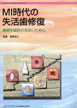 MI時代の失活歯修復 歯根を破折させないために クイント・ブックレットシリーズ