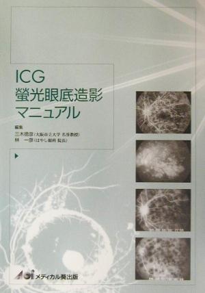 ICG蛍光眼底造影マニュアル