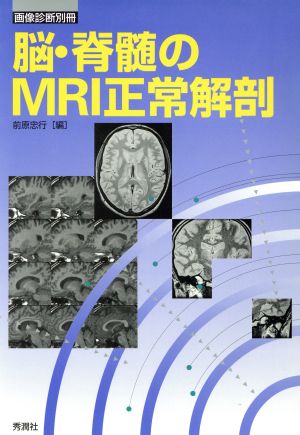 脳・脊髄のMRI正常解剖 画像診断別冊