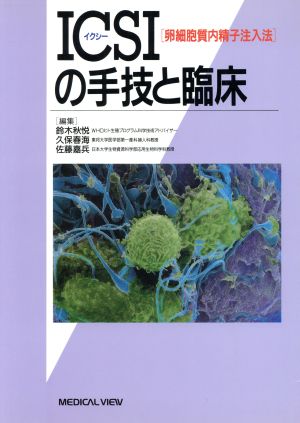 ICSI「卵細胞質内精子注入法」の手技と臨床