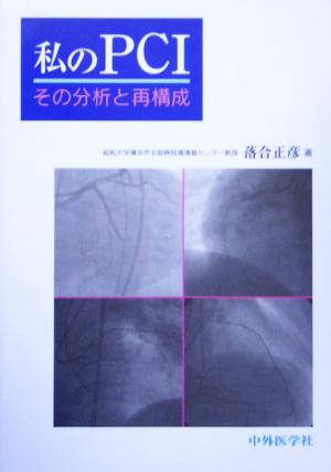 私のPCI その分析と再構成