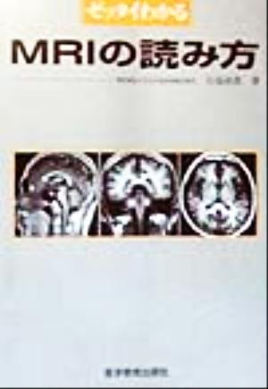 ゼッタイわかる MRIの読み方 中古本・書籍 | ブックオフ公式オンライン 