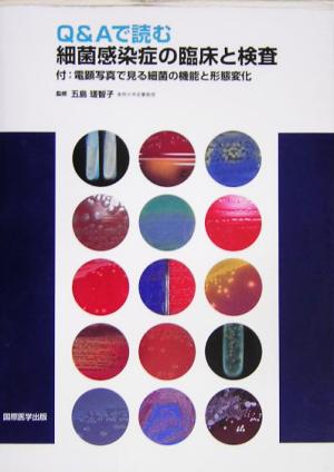 Q&Aで読む細菌感染症の臨床と検査 付:電顕写真で見る細菌の機能と形態変化