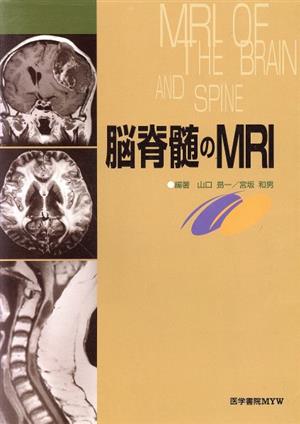 脳脊髄のMRI