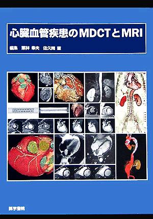 心臓血管疾患のMDCTとMRI