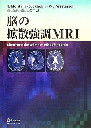 脳の拡散強調MRI