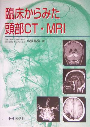 臨床からみた頭部CT・MRI