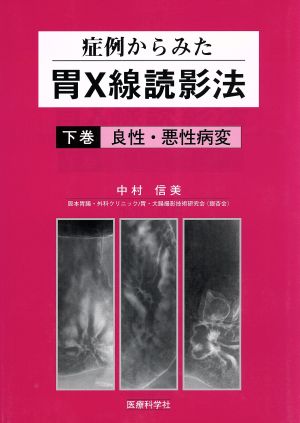 症例からみた胃X線読影法(下巻) 良性・悪性疾患