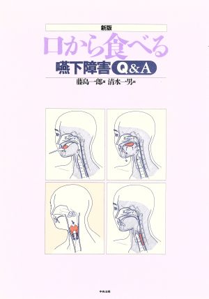 口から食べる嚥下障害Q&A