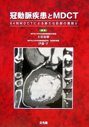 冠動脈疾患とMDCT 64列MDCTによる新たな診断の幕開け