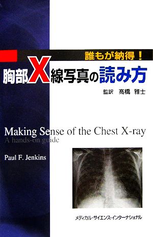 誰もが納得！胸部X線写真の読み方