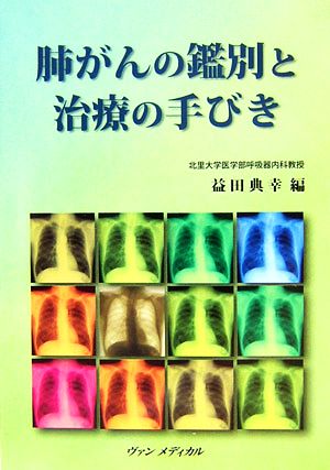 肺がんの鑑別と治療の手びき