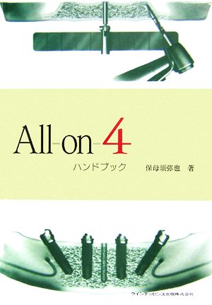 All-on-4ハンドブック