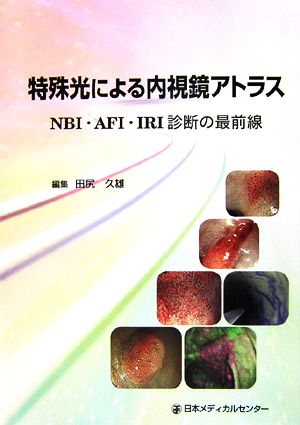 特殊光による内視鏡アトラス NBI・AFI・IRI診断の最前線