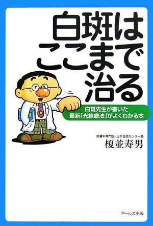 白斑はここまで治る 白斑先生が書いた最新光線療法がよくわかる本