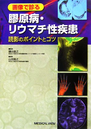 画像で診る膠原病・リウマチ性疾患 読影のポイントとコツ