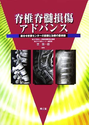 脊椎脊髄損傷アドバンス : 総合せき損センターの診断と治療の最前線