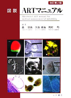 図説 ARTマニュアル