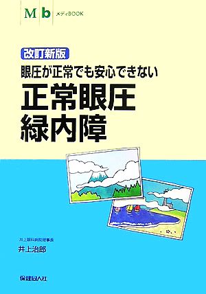 正常眼圧緑内障 眼圧が正常でも安心できない メディBOOKシリーズ