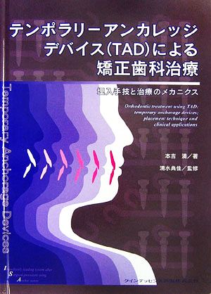 テンポラリーアンカレッジデバイスによる矯正歯科治療 埋入手技と治療のメカニクス