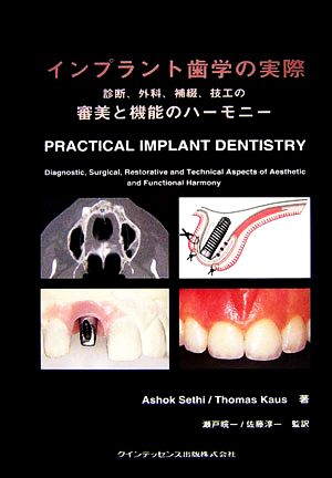 インプラント歯学の実際 診断、外科、補綴、技工の審美と機能のハーモニー