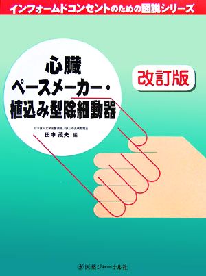 心臓ペースメーカー・植込み型除細動器 インフォームドコンセントのための図説シリーズ