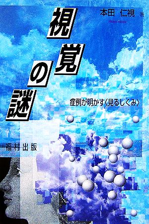 視覚の謎 症例が明かす“見るしくみ