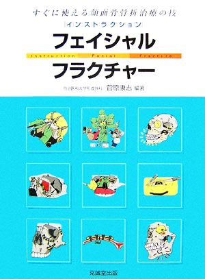 インストラクション・フェイシャルフラクチャー すぐに役立つ顔面骨折治療の技