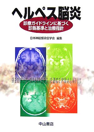 ヘルペス脳炎 診療ガイドラインに基づく診断基準と治療指針