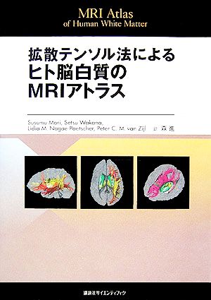 拡散テンソル法によるヒト脳白質のMRIアトラスMRI Atlas of Human White Matter