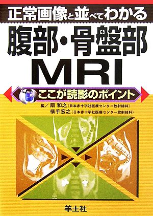 正常画像と並べてわかる腹部・骨盤部MRI ここが読影のポイント