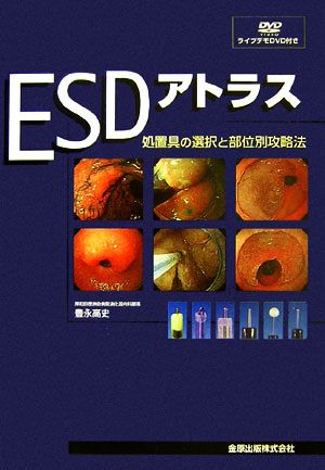 ESDアトラス 処置具の選択と部位別攻略法