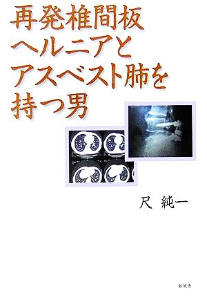 再発椎間板ヘルニアとアスベスト肺を持つ男