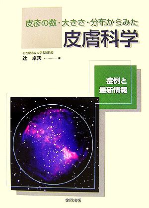 皮疹の数・大きさ・分布からみた皮膚科学 症例と最新情報