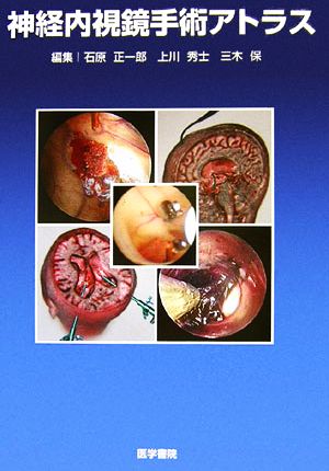 神経内視鏡手術アトラス