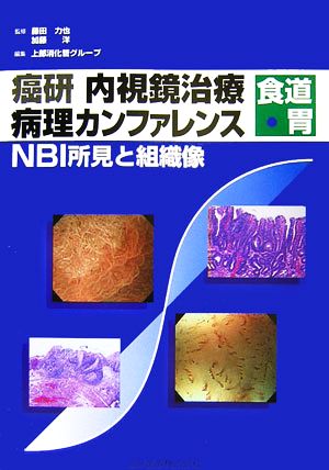 癌研内視鏡治療病理カンファレンス 食道・胃 NBI所見と組織像