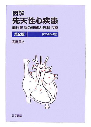 図解 先天性心疾患 第2版 血行動態の理解と外科治療 新品本・書籍 