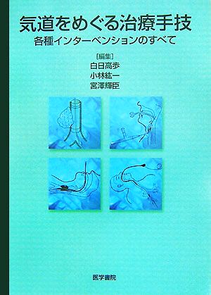 気道をめぐる治療手技 各種インターベンションのすべて