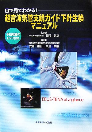 目で見てわかる！超音波気管支鏡ガイド下針生検マニュアル