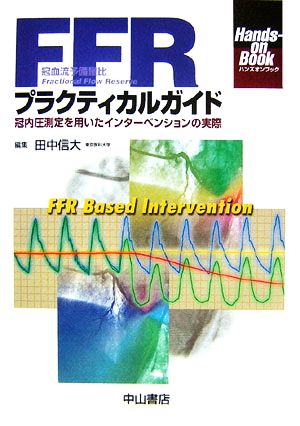 FFRプラクティカルガイド 冠内圧測定を用いたインターベンションの実際 Hands-on Book