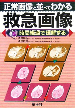 正常画像と並べてわかる救急画像 時間経過で理解する